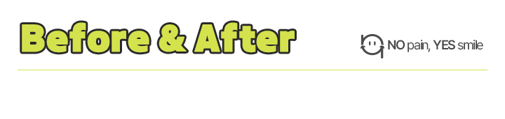 before&after